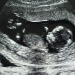 【妊娠四ヶ月】妊娠十二週目！葉酸サプリ始めました。