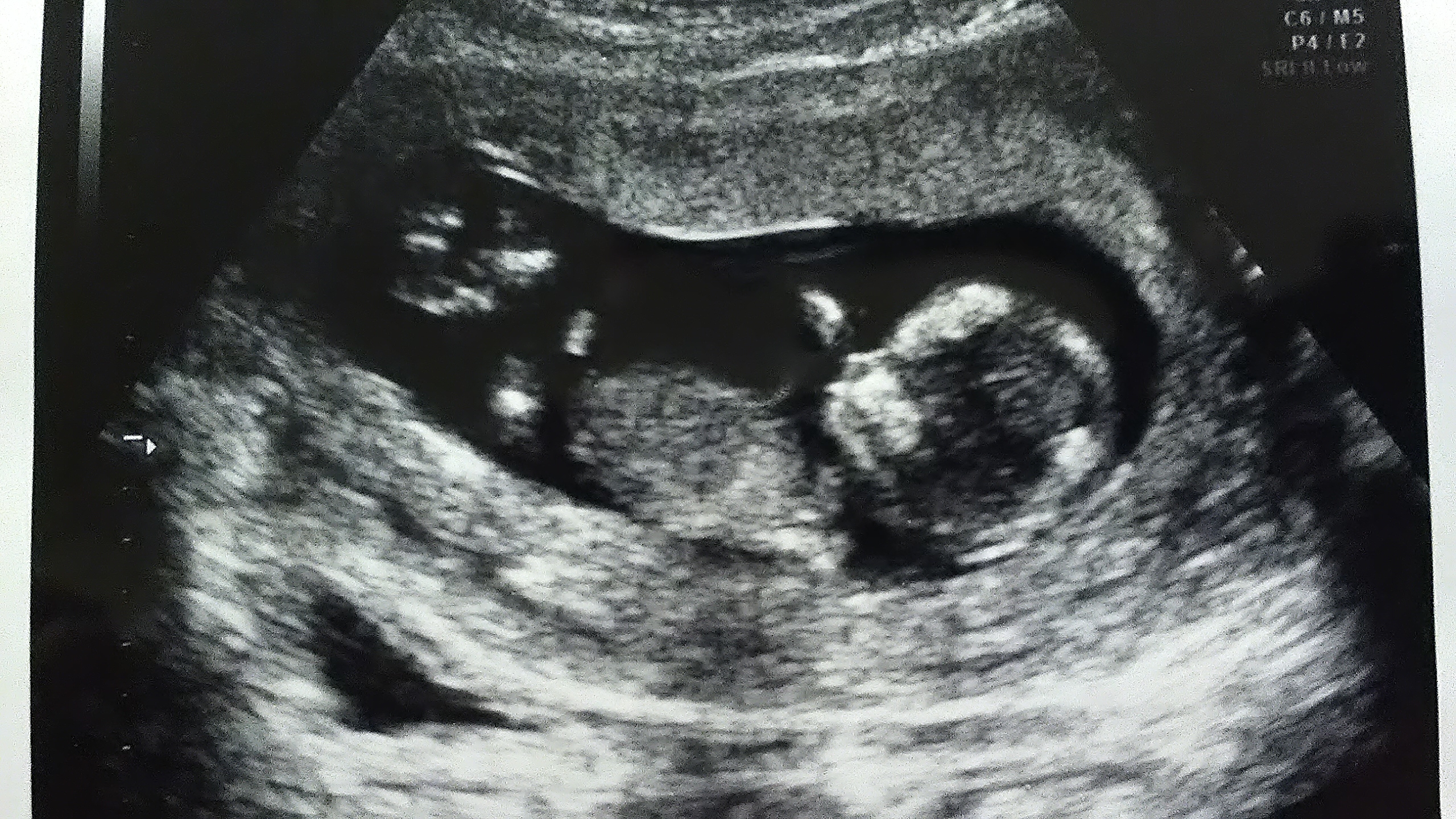 妊娠四ヶ月 妊娠十二週目 葉酸サプリ始めました 今日もライフは満タンだ