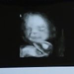 【妊娠7ヶ月】活発な胎児が仏の顔で微笑んでいました。寝返り・まばたきも。